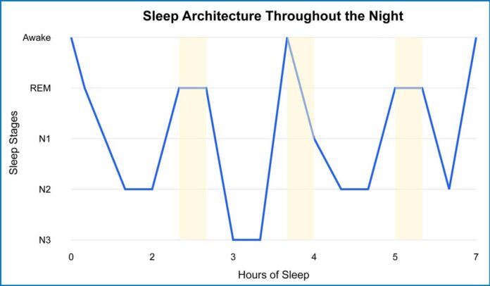 Sleep - BeSund